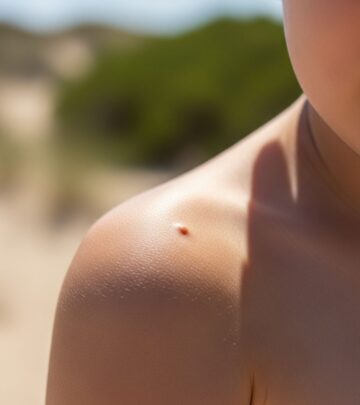 Understanding skin cancer in children: early detection, prevention strategies, and treatment options.